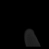 SPORK, NICO - 22.03.1976 - 02.08.2022 - CT obere Extremität - 17:58:51